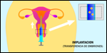 transferencia de embriones