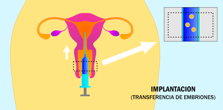 Transferencia de Embriones